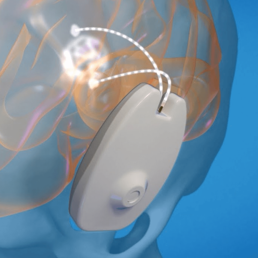 CraniUS closes $20M financing to support blood-brain barrier tech for drug delivery