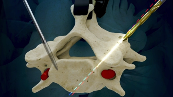LEM Surgical wins new FDA clearance for humanoid surgical robot