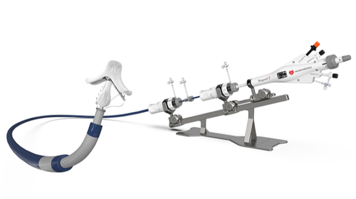 Valgen earns CE mark for mitral valve repair system