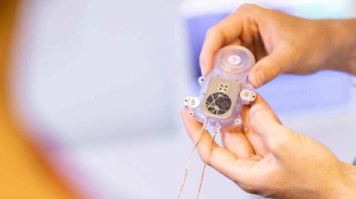 Ability Neurotech completes first-in-human brain-computer interface procedure