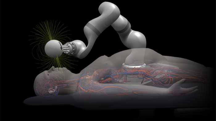 Magnendo raises $18M Series A to advance magnetic robotic navigation for stroke care