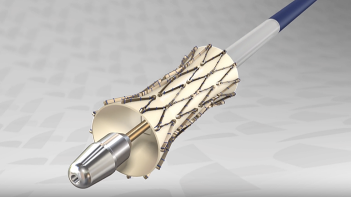 enVVeno Medical wins FDA IDE for pivotal trial of transcatheter venous valve