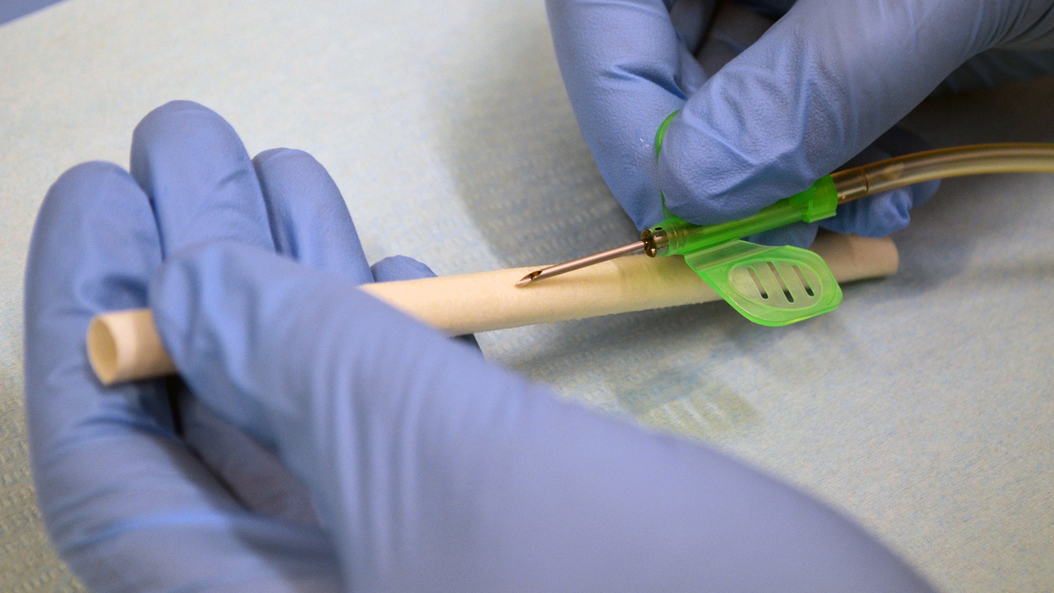 Dialybrid Silkothane Graft