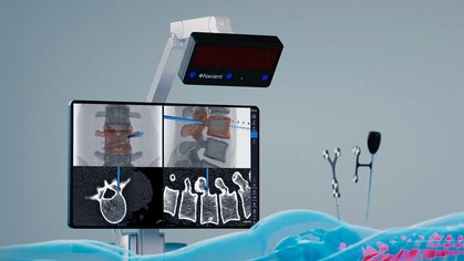 ClaroNav Kolahi Navient Surgical Navigation System
