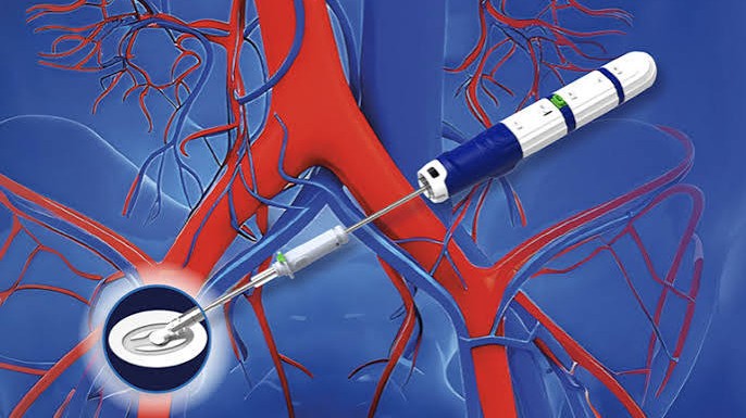 Haemonetics PerQseal Elite vascular closure system