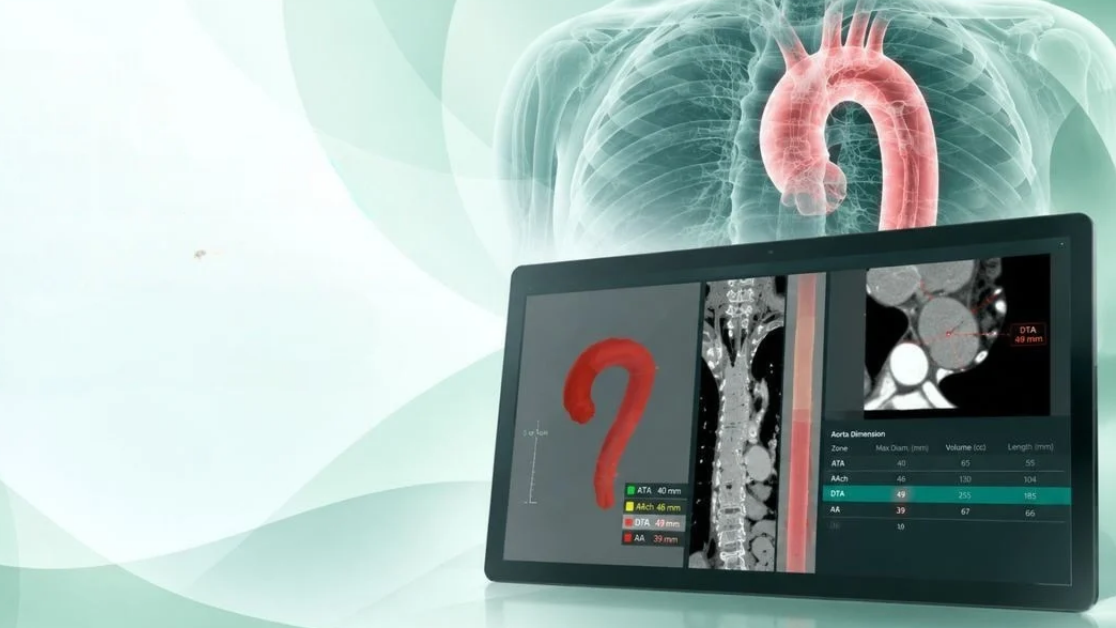Coreline Soft AVIEW Aorta Metrics